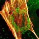 Image for article titled A Cure for Heart Disease That Lurks In Your Own Stem Cells